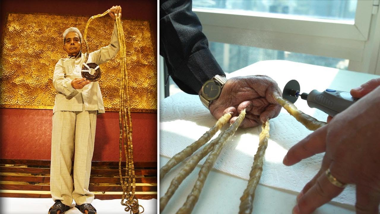 Indian Man With World’s Longest Fingernails Flies to New York to Have Them Cut