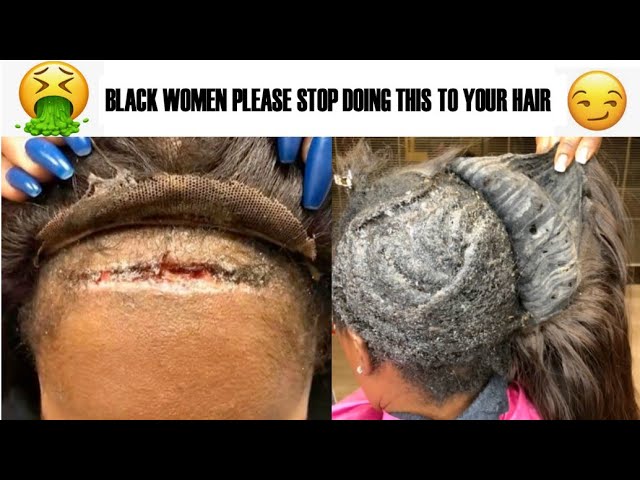 MUST WATCH! BLACK WOMEN & HAIR DAMAGE| Natural Hair Horror Story | A Rant