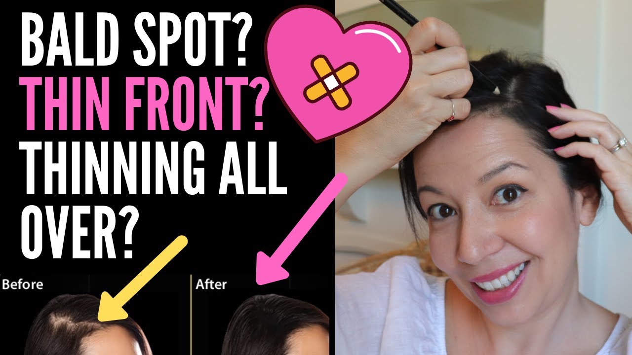 HIDING THINNING HAIR ON TOP FOR FEMALES: HAIRSTYLE Tips For BALD Spots, Thin Fronts And Parts!