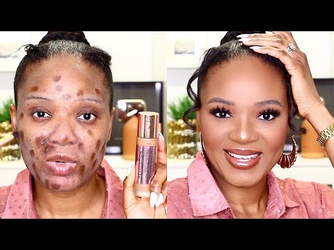 TRY THIS TRICK FOR ENLARGED PORES, ACNE & HYPERPIGMENTATION (MAKEUP TIPS) | OMABELLETV