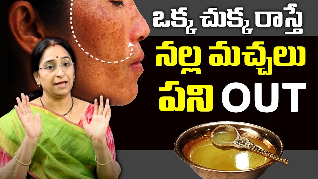 Ramaa Raavi – Skin Care Tips – Simple Home Remedies Dor Black Spots, Acne and Pimples from Face