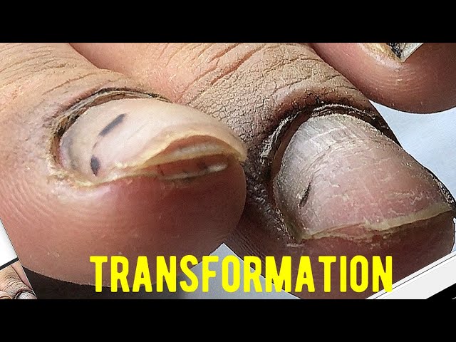 AFTER PANDEMIC #HARDWORKER WOMANS FACE AND NAILS #TRANSFORMATION AND HER HARD LIFE STORY