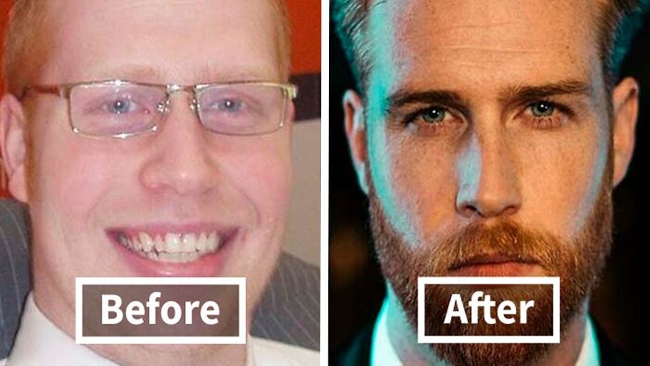 Men Who Are Now Rocking A Bearded Look Share How They Looked Before